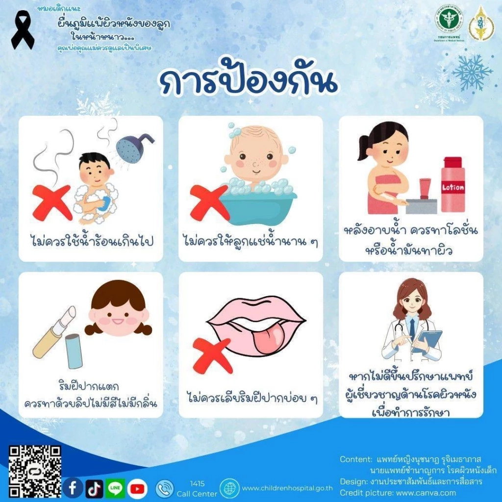 ผิวลูกน้อยแพ้ง่ายในช่วงหน้าหนาว พ่อแม่ควรดูแลอย่างไร