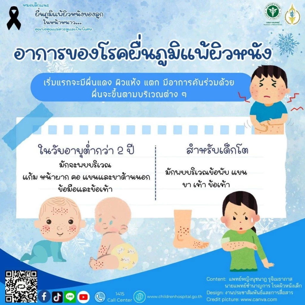 ผิวลูกน้อยแพ้ง่ายในช่วงหน้าหนาว พ่อแม่ควรดูแลอย่างไร