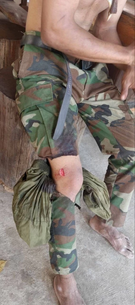 หินบาดหรือเปล่า! ภาพ "ทหารกัมพูชา" อ้างถูกยิงจากฝั่งไทยที่ "ช่องอานม้า"