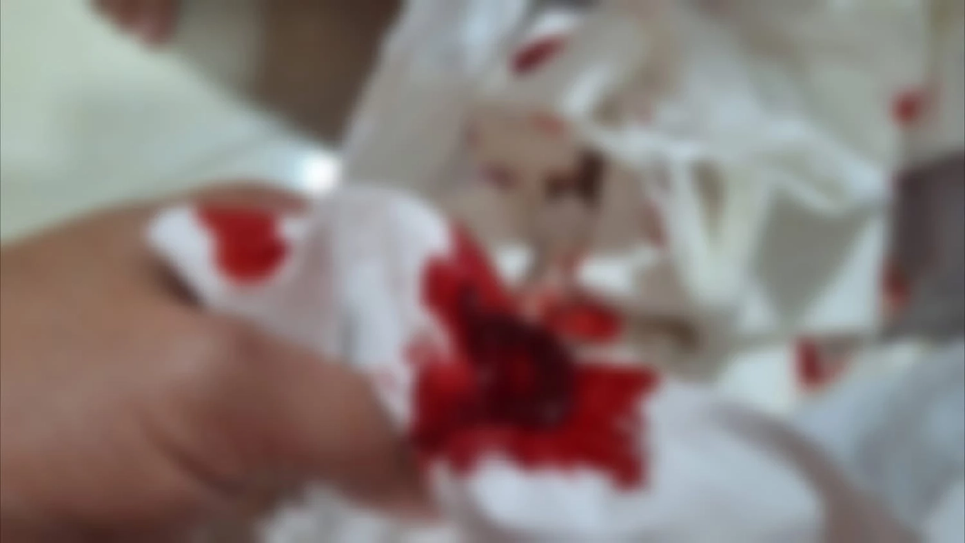 เชียงใหม่ฝุ่นควันวิกฤตหนัก 8 ขวบ เลือดกำเดาพุ่งเป็นลิ่ม-เชียงดาววิกฤตหนัก