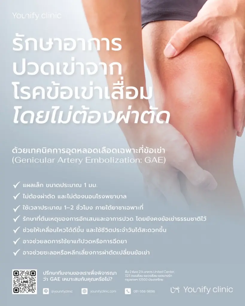 ทางเลือกใหม่รักษาข้อเข่าเสื่อม "GAE" ตัดวงจรปวดแบบไม่ต้องผ่าตัด