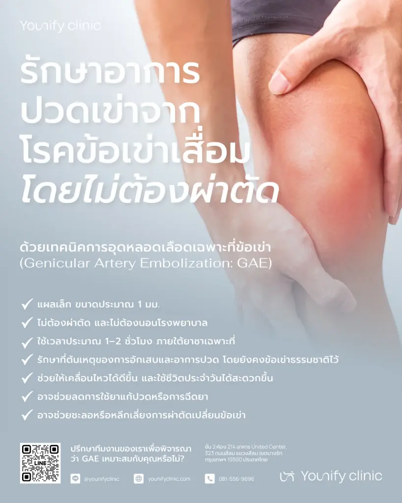 ทางเลือกใหม่รักษาข้อเข่าเสื่อม "GAE" ตัดวงจรปวดแบบไม่ต้องผ่าตัด