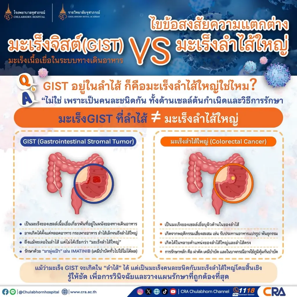 ข่าวดีผู้ป่วยบัตรทอง! ยามะเร็งมุ่งเป้าพระราชทานล็อตแรกถึง อภ. แล้ว