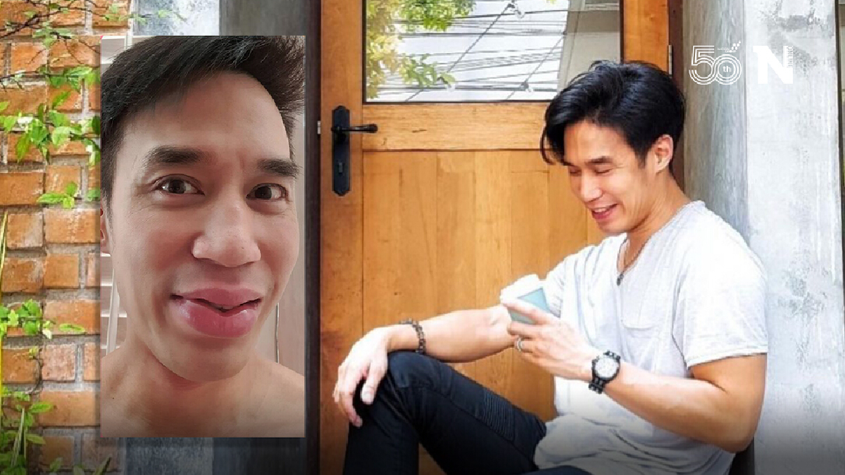 แฟนๆช็อก! "ดอม เหตระกูล" ปากบวมฉึ่งหลังฉีดวัคซีนโควิด แฟนๆช็อก! "ดอม เหตระกูล" ปากบวมฉึ่งหลังฉีดวัคซีนโควิด