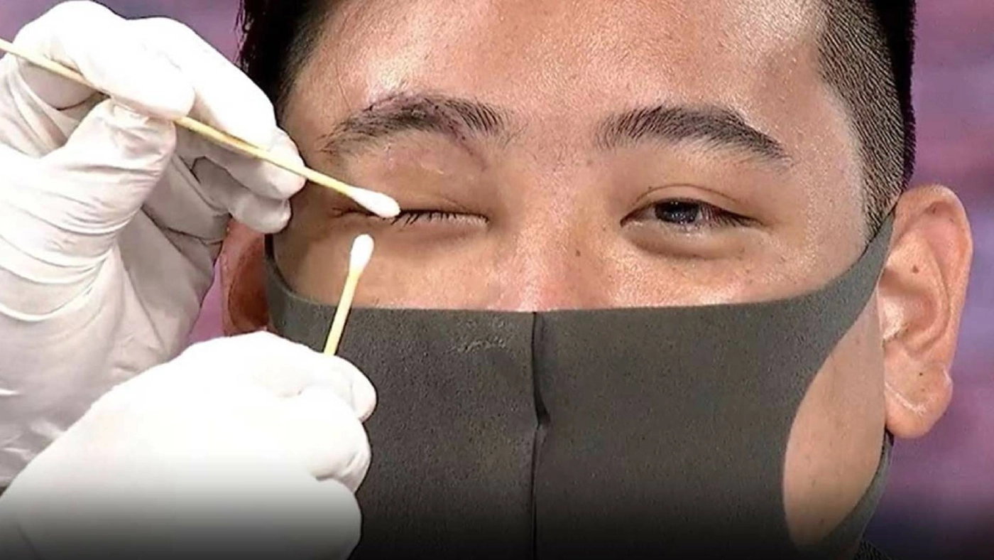 “ไฮโซลูกนัท” เปิดใบรับรองแพทย์ ระบุชัด “ตาขวาบอด”