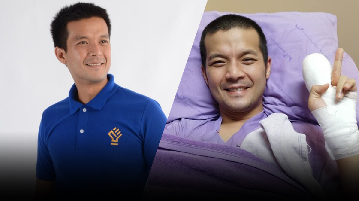 อัปเดตอาการล่าสุด “อะตอม สัมพันธภาพ” ร่างกายดีขึ้นสมองต้องใช้เวลาฟื้นฟู อัปเดตอาการล่าสุด “อะตอม สัมพันธภาพ” ร่างกายดีขึ้นสมองต้องใช้เวลาฟื้นฟู