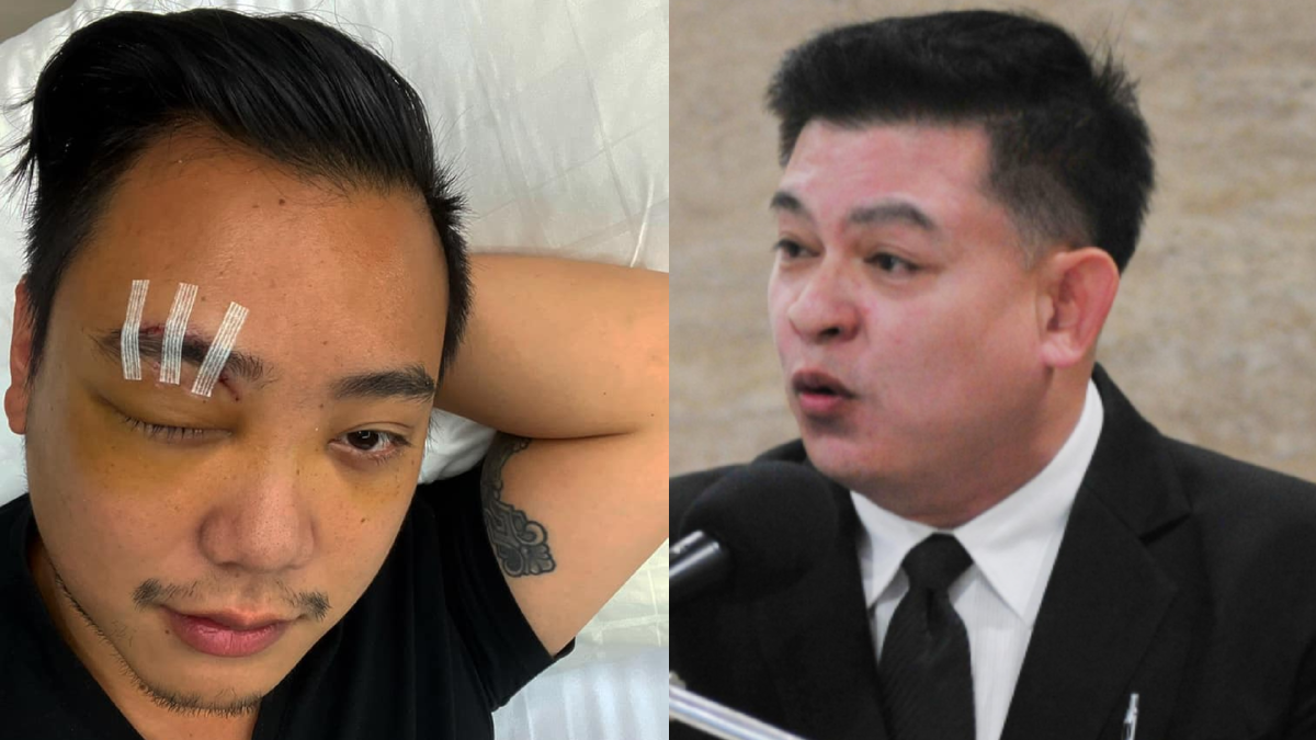 "สิระ" ท้า "ไฮโซลูกนัท" โชว์ใบรับรองแพทย์ ลั่นตาบอดจริงให้ 1 ล้าน