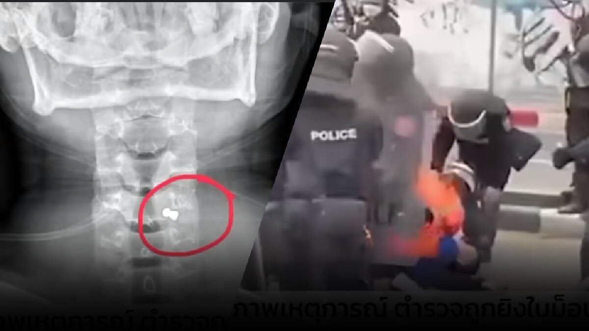 เปิดภาพ คฟ.ถูกยิงร่วงกลางม็อบ ฝากถึงมือปืน ‘ผมก็มีครอบครัวต้องกลับไปหา’