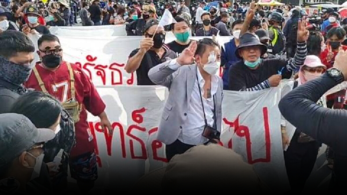 “ไฮโซลูกนัท” ท้าคนไม่เชื่อ “มาแหกตาดู” บอดจริงไหม “ไฮโซลูกนัท” ท้าคนไม่เชื่อ “มาแหกตาดู” บอดจริงไหม