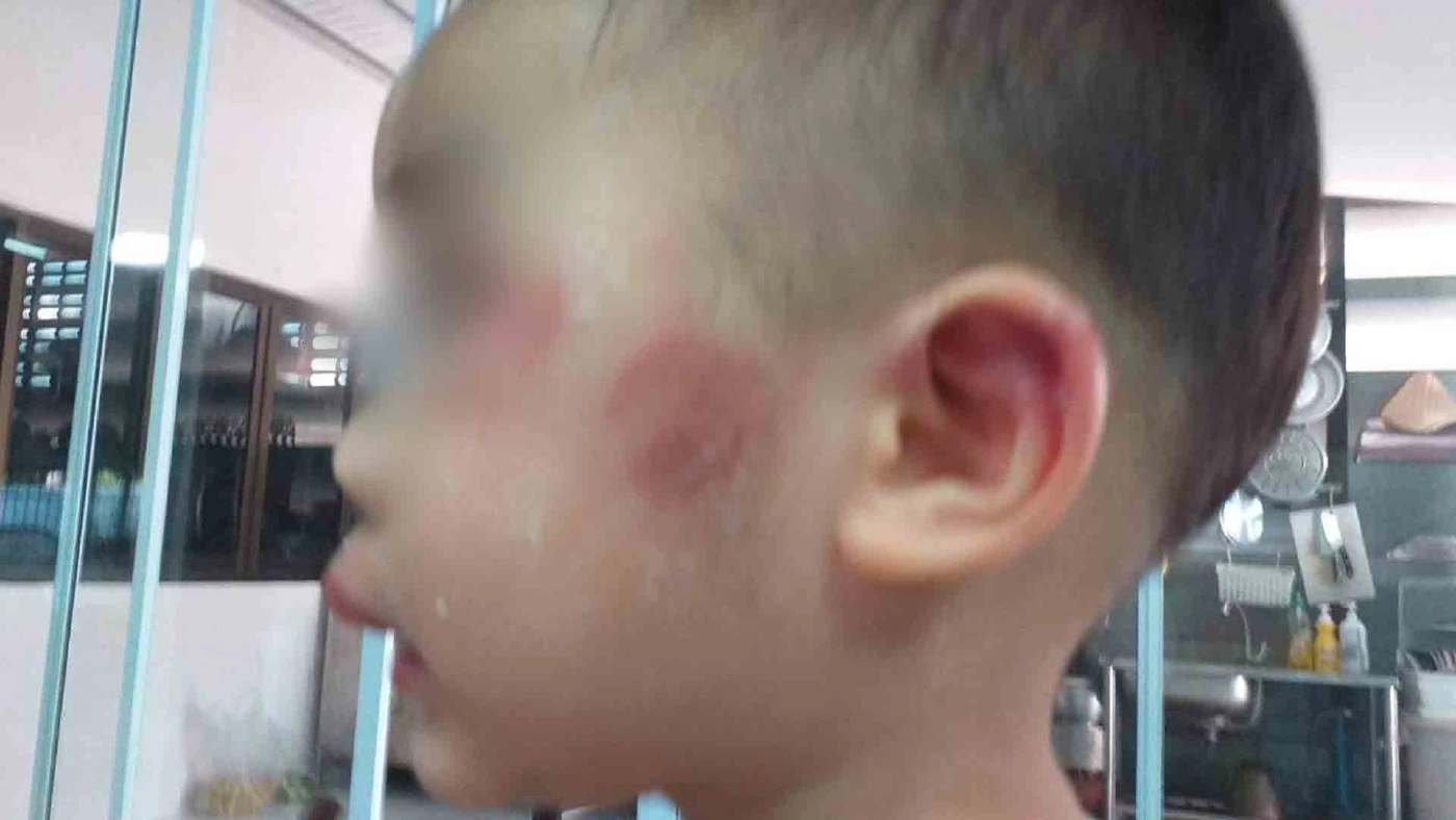 แม่ร้องสื่อลูกขวบ 9 เดือนถูกเพื่อนทำร้ายขอดูวงจรปิดบอกกล้องเสีย