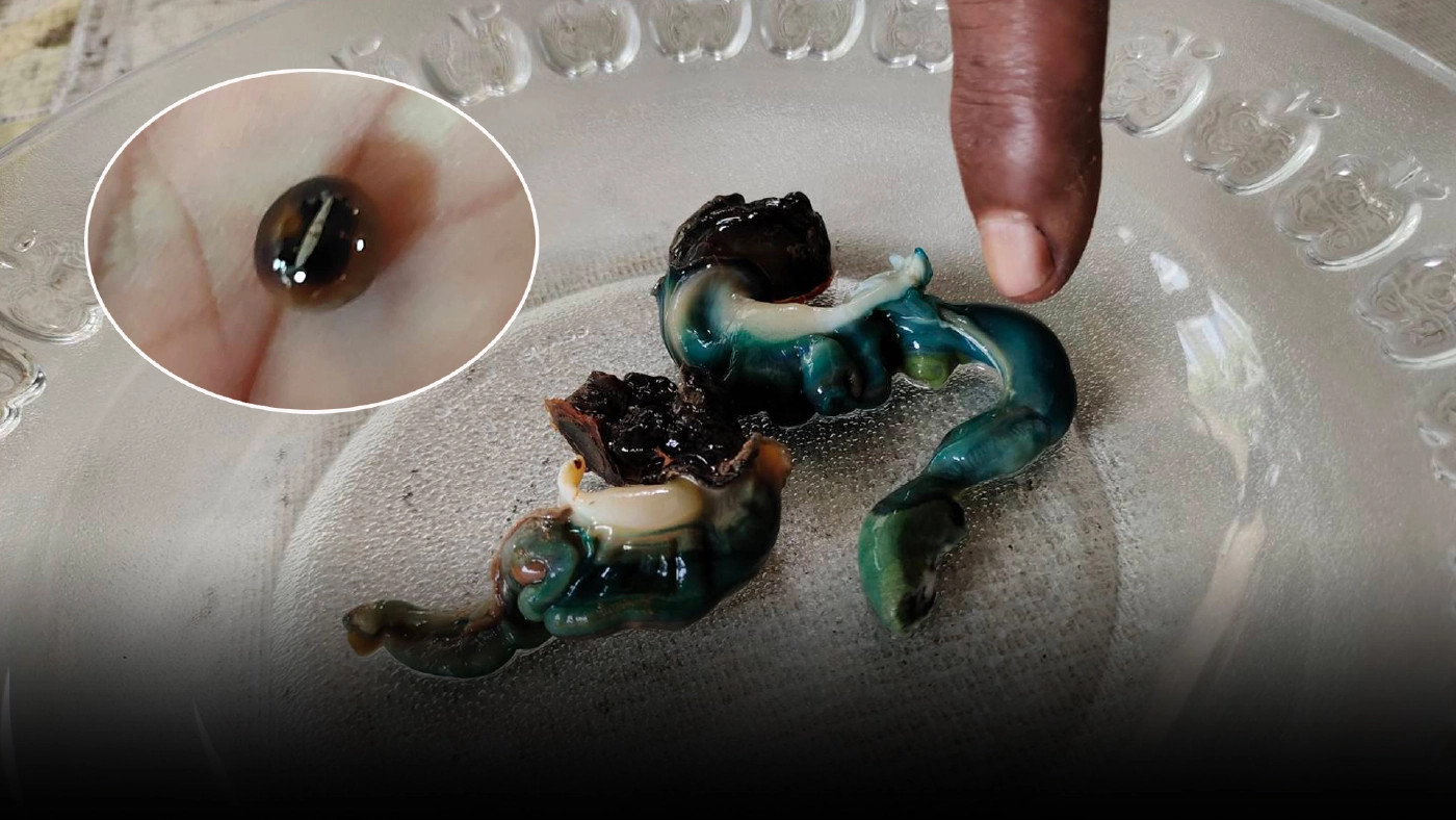 ชาวกระบี่พบ "ไข่มุกดำ" หายากในหอยสันขวานเกือบกลืนลงท้อง