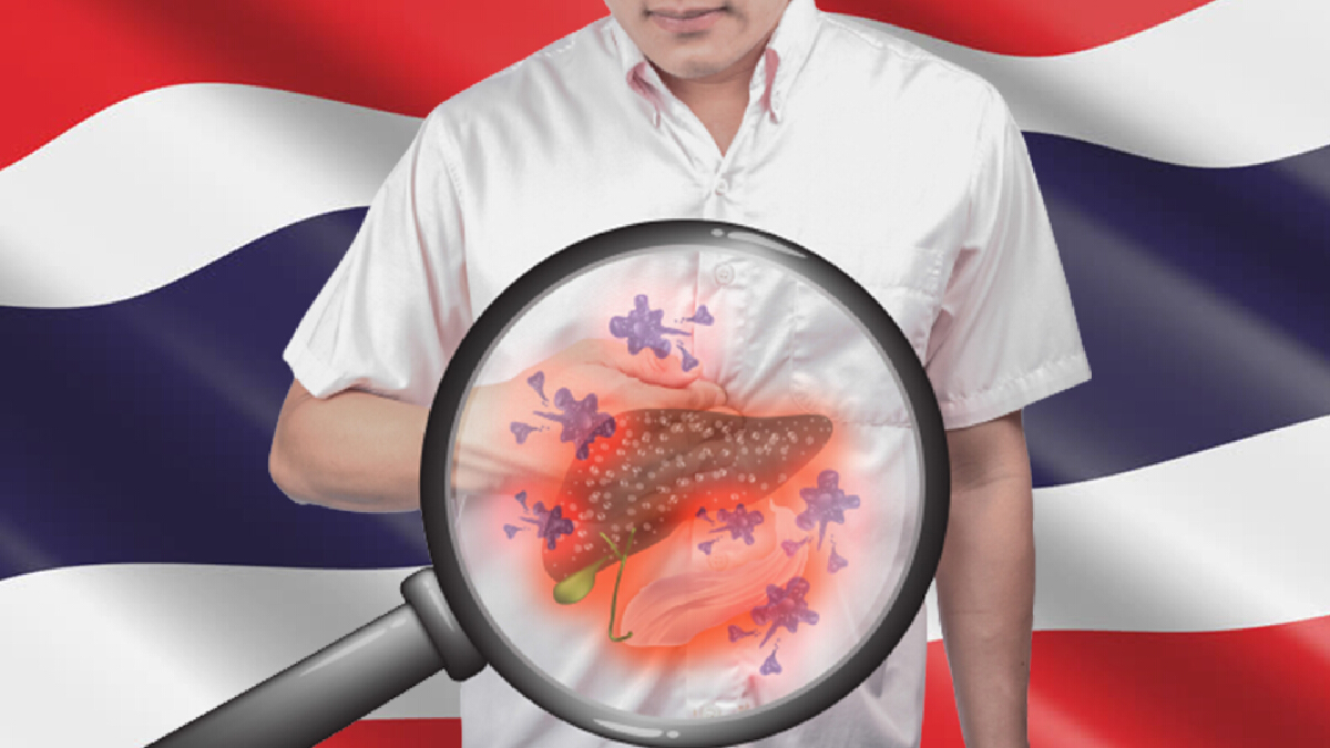 มะเร็งตับพบมากเป็นอันดับ 1 ของมะเร็งทั้งหมดในคนไทย มะเร็งตับพบมากเป็นอันดับ 1 ของมะเร็งทั้งหมดในคนไทย