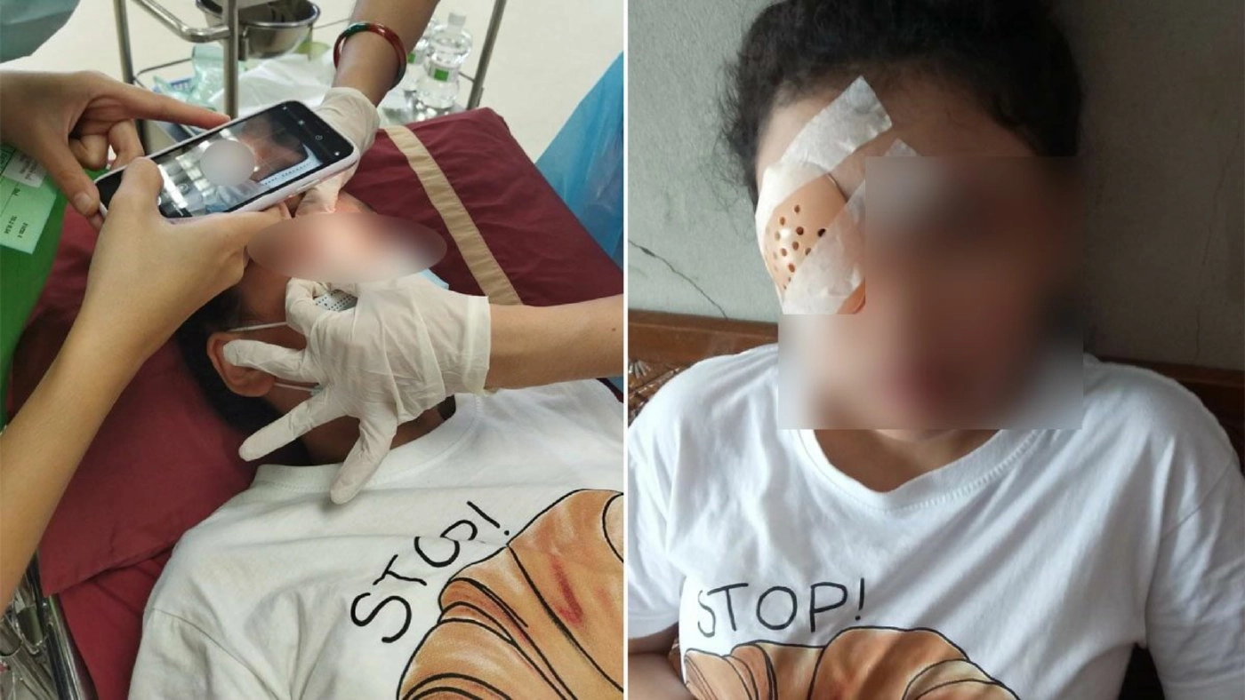 เตือนภัยผู้ปกครอง เด็กวัย 12 เรียนออนไลน์ จนเส้นเลือดฝอยในตาแตก