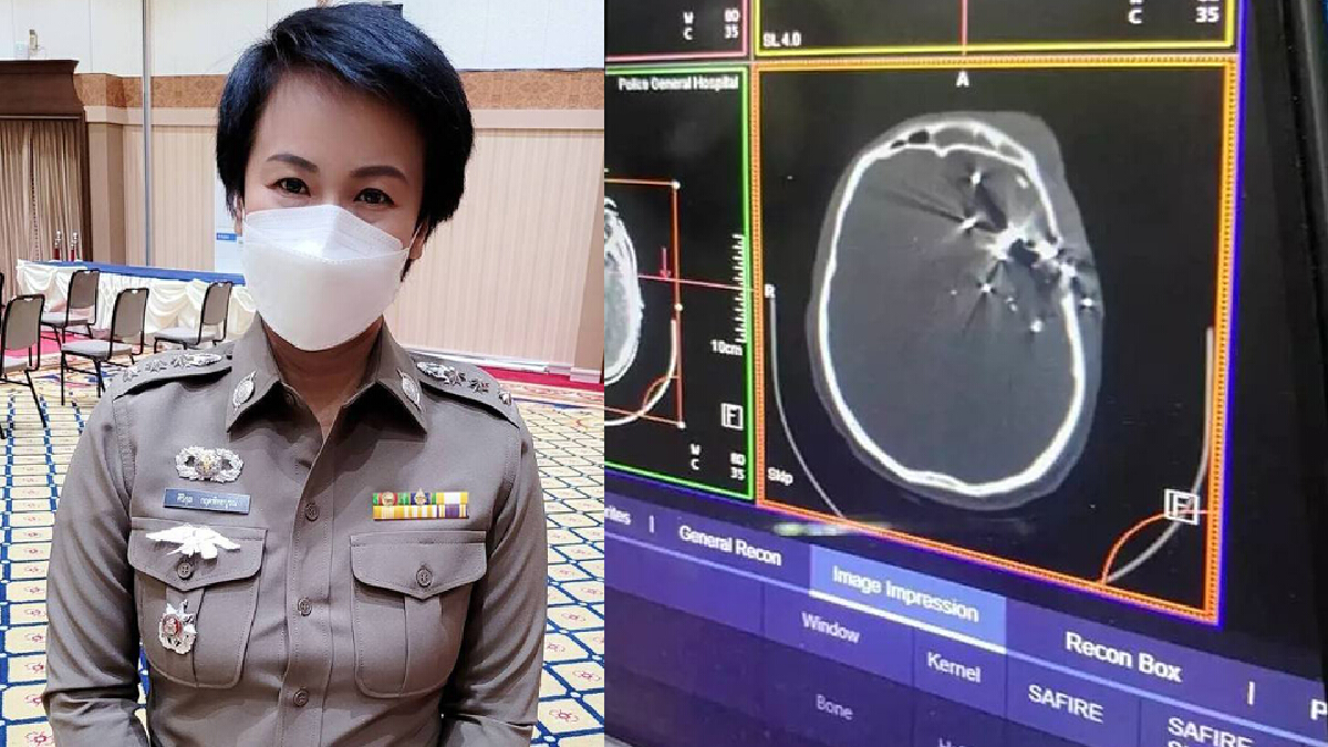 รองโฆษก ตร.เผยผลคืบหน้าอาการ 2 ผบ.หมู่ .คฝ. รองโฆษก ตร.เผยผลคืบหน้าอาการ 2 ผบ.หมู่ .คฝ.