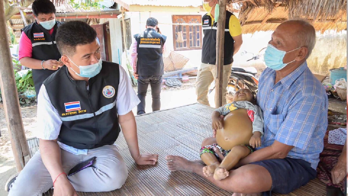 เด็กชายท้องโตถูกส่งรพ.ศิริราชหวังปลูกถ่ายตับ