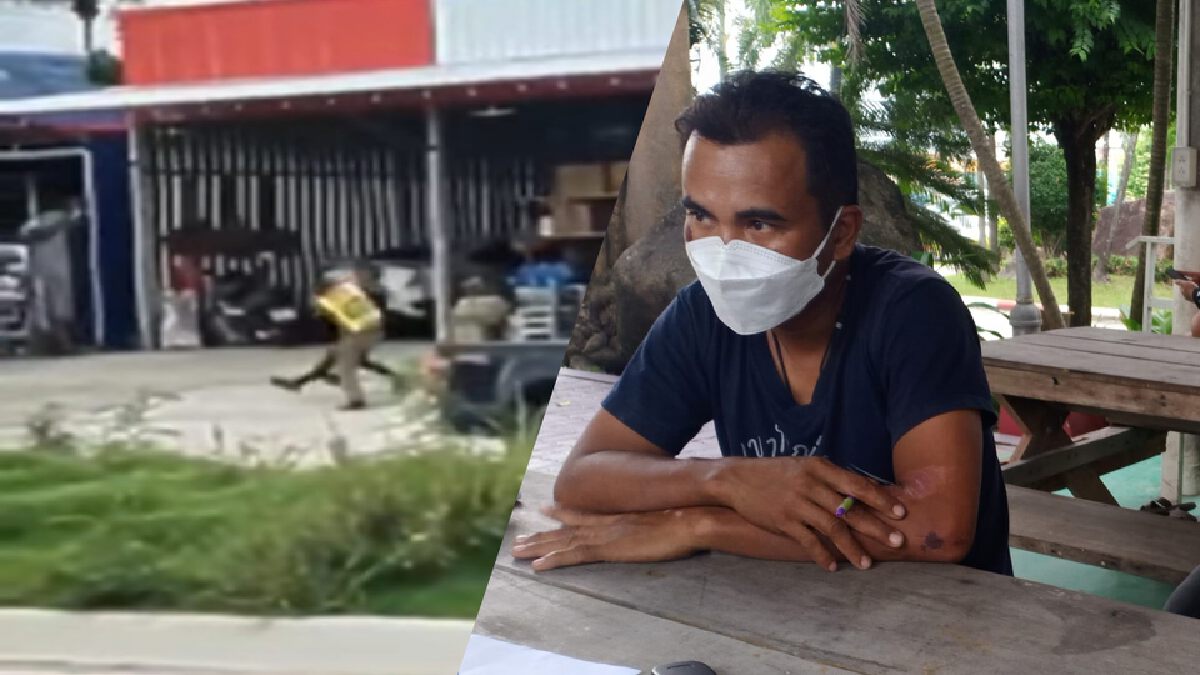 หนุ่มอ้างถูกตำรวจ "เตะตัดขา" ได้รับบาดเจ็บ สาเหตุไม่ยอมให้ยึดรถ หนุ่มอ้างถูกตำรวจ "เตะตัดขา" ได้รับบาดเจ็บ สาเหตุไม่ยอมให้ยึดรถ