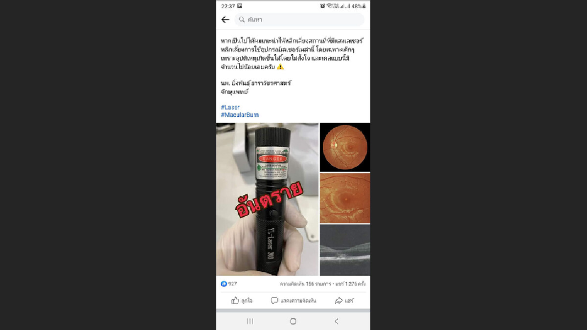 จักษุแพทย์เตือนภัย-แสงเลเซอร์เข้าตาถึงขั้นมองไม่เห็น จักษุแพทย์เตือนภัย-แสงเลเซอร์เข้าตาถึงขั้นมองไม่เห็น