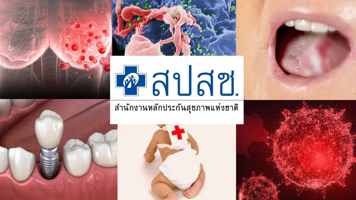 สปสช.เคาะ 6 สิทธิประโยชน์ใหม่  รักษาอาการอักเสบจากโควิด-19