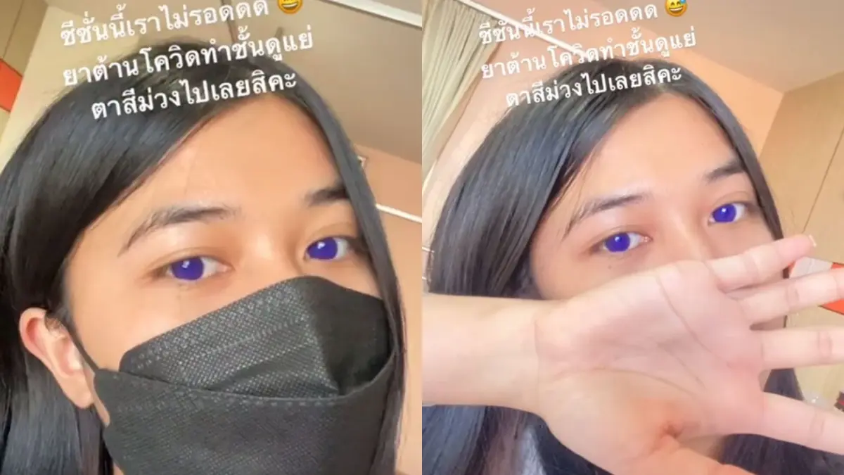 ฮือฮา! สาวโพสต์กินยาฟาวิพิราเวียร์แล้วตากลายเป็นสีม่วง ฮือฮา! สาวโพสต์กินยาฟาวิพิราเวียร์แล้วตากลายเป็นสีม่วง