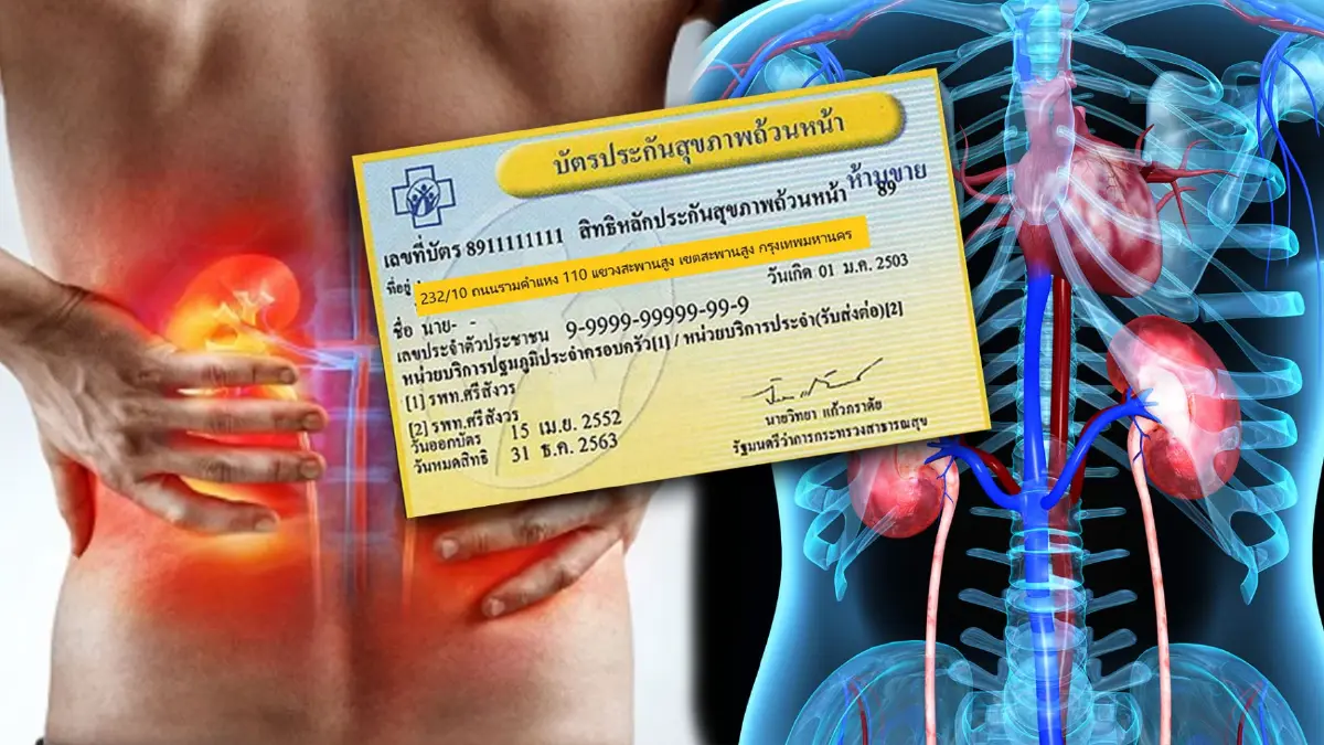 สปสช.เคาะ ไตวายสิทธิบัตรทอง เลือกใช้วิธีฟอกเลือดได้ ไม่ต้องจ่ายเงินเอง