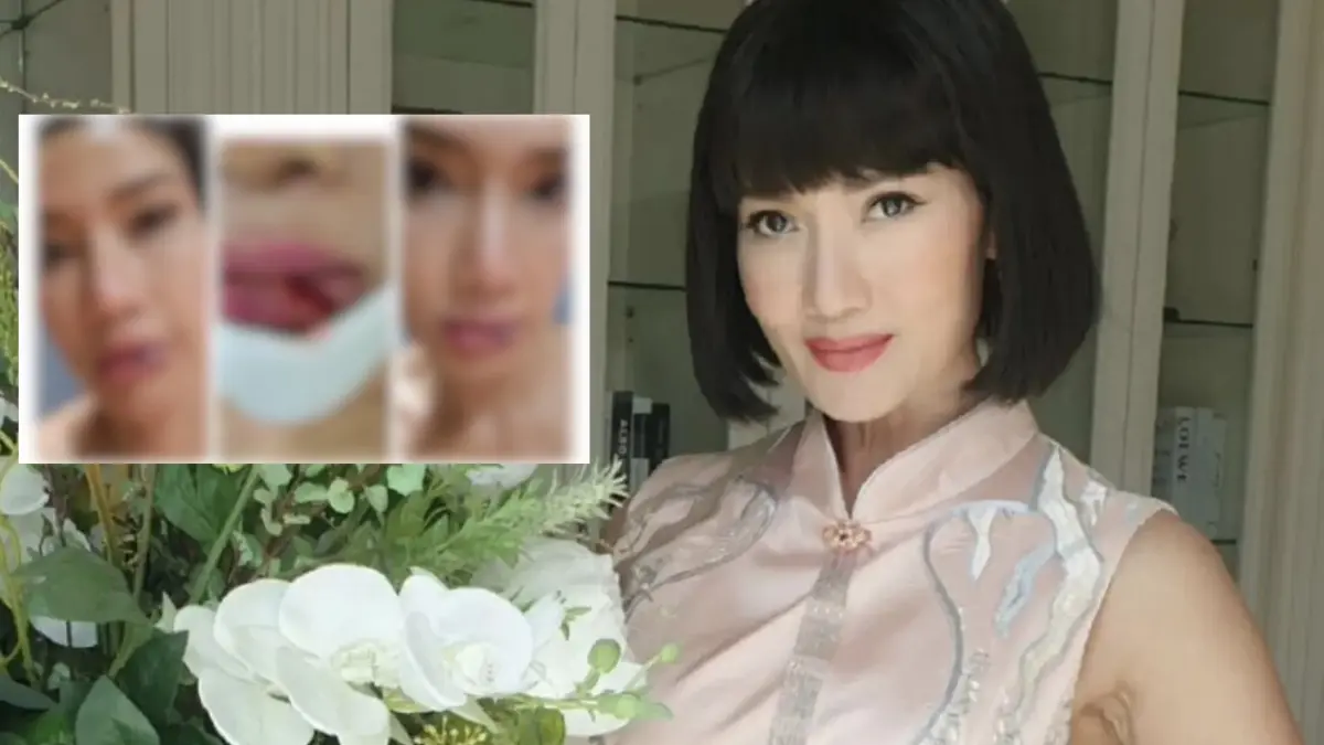 ส่งกำลังใจ  “ดี้ ชนานา” หวิดเสียโฉม ประสบอุบัติเหตุ รถไถลเข้าชนเสาไฟฟ้า