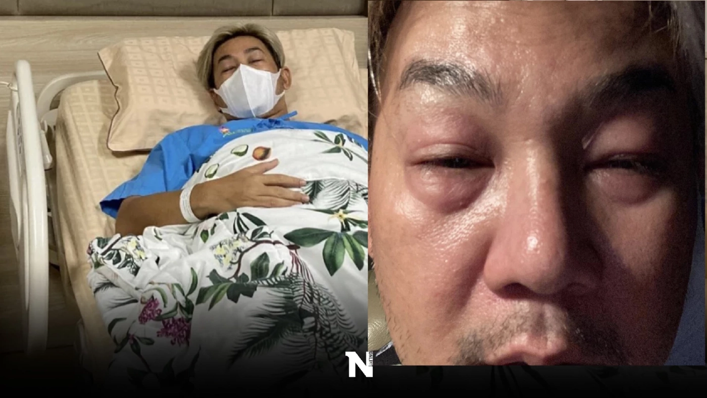 “เอ๊าะ กีรติ” พิธีกรชื่อดัง แอดมิทด่วน ครอบครัวเผยภาพใบหน้า FC สุดห่วงใย