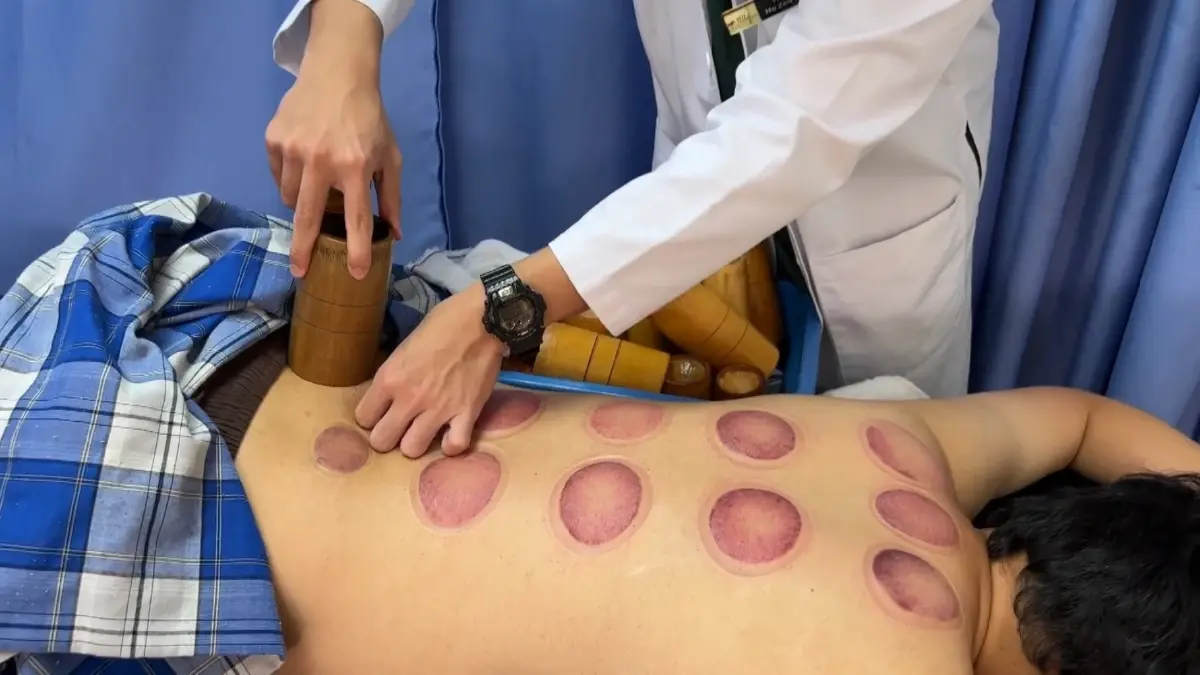 แพทย์แผนจีนเผยแพร่สู่มาเลเซีย (คลิป) แพทย์แผนจีนเผยแพร่สู่มาเลเซีย (คลิป)
