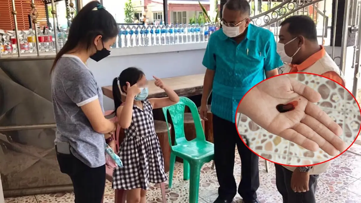 แพทย์รับน้องแพรวารักษาอาการเลือดออกตามผิวหนัง แพทย์รับน้องแพรวารักษาอาการเลือดออกตามผิวหนัง