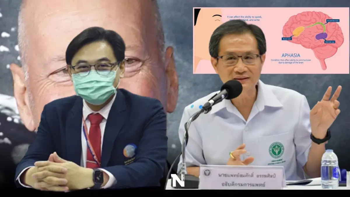 แพทย์แนะนำ ป่วยโรคอะเฟเซีย อย่าวางใจ ควรรีบพบแพทย์ทันที