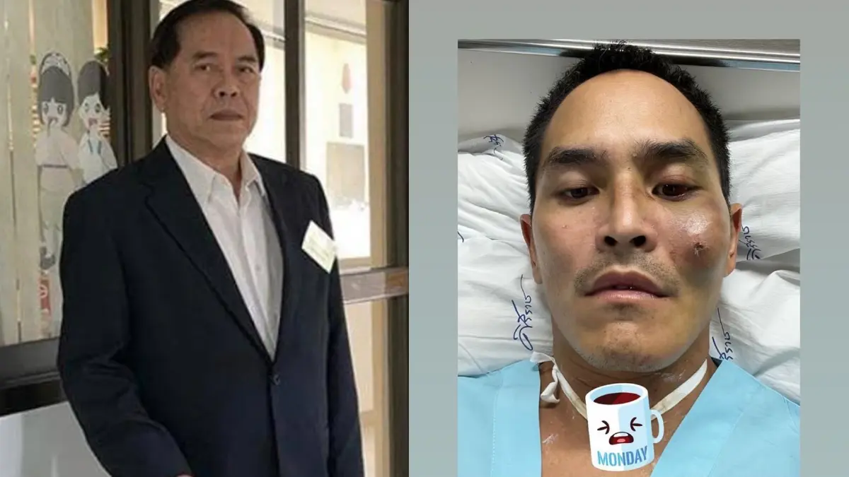 คุณปู่ไพวงษ์ เล่าวินาที "สงกรานต์" เกิดประสบอุบัติเหตุต้องเข้า ICU นาน7วัน คุณปู่ไพวงษ์ เล่าวินาที "สงกรานต์" เกิดประสบอุบัติเหตุต้องเข้า ICU นาน7วัน