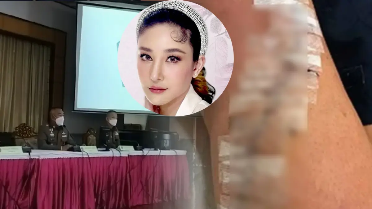 ตร.ขอโทษ นำภาพต่างประเทศมาสื่อสารเทียบแผลใบพัดขา "แตงโม" ตร.ขอโทษ นำภาพต่างประเทศมาสื่อสารเทียบแผลใบพัดขา "แตงโม"