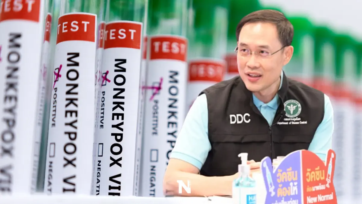 กรมควบคุมโรค เปิดนิยาม “ผู้ป่วยสงสัย-ผู้เข้าข่าย-ผู้ป่วยยืนยัน” ฝีดาษลิง