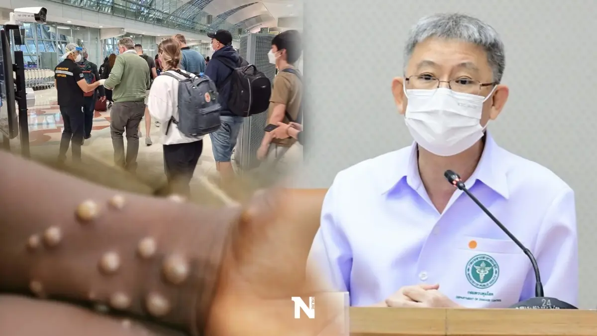 สถานการณ์ "ฝีดาษลิง" ทั่วโลก 344 ราย สธ.เข้มกลุ่มเสี่ยงสังเกตุอาการ 21 วัน
