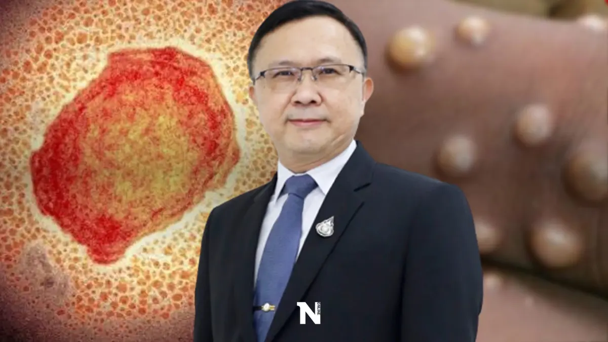 กรมวิทย์ฯ มั่นใจศักยภาพวินิจฉัย"ฝีดาษลิง" พร้อมตรวจรับรองวัคซีนจากสหรัฐฯ กรมวิทย์ฯ มั่นใจศักยภาพวินิจฉัย"ฝีดาษลิง" พร้อมตรวจรับรองวัคซีนจากสหรัฐฯ