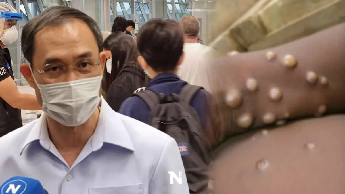 ผวา!! สธ.ไทยติดตามผู้สัมผัสใกล้ชิด "ฝีดาษลิง” 12 ราย พบมาต่อเครื่องที่ไทย