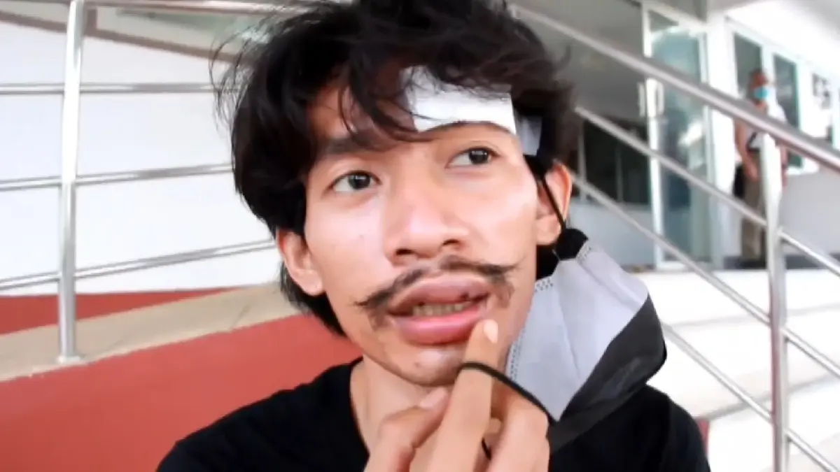 เหยื่อถูกลูกหลงวัยรุ่นตะลุมบอนงานแห่บั้งไฟบาดเจ็บ โร่แจ้งความ