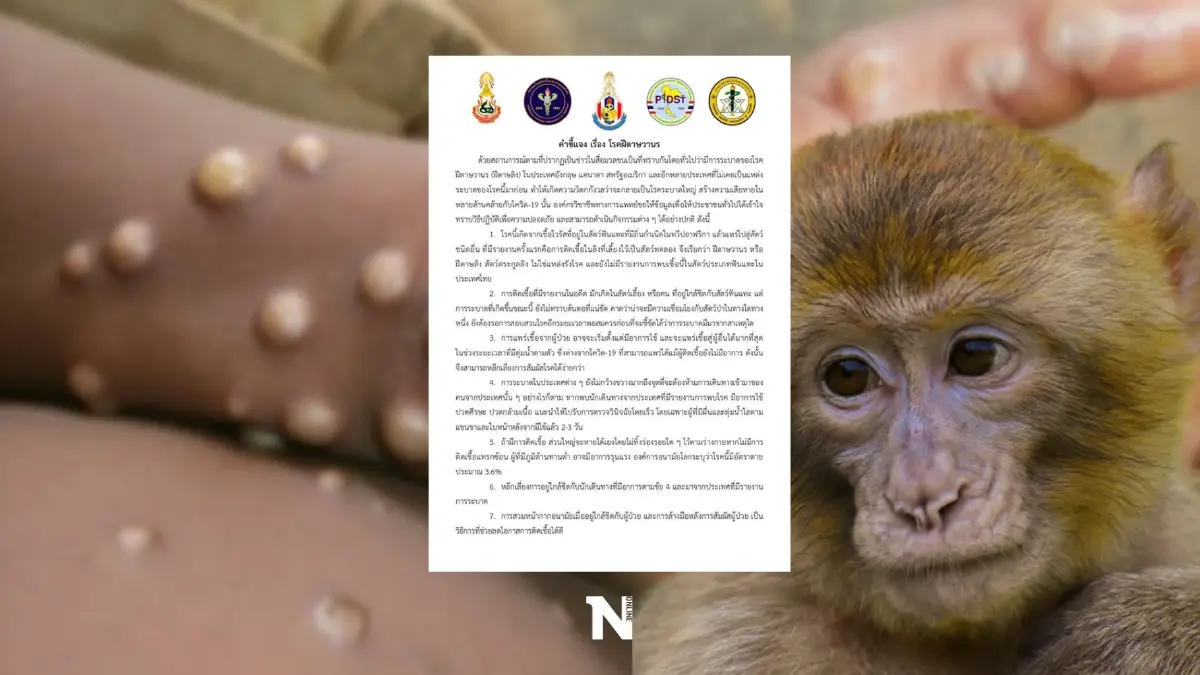 5 องค์กรวิชาชีพแพทย์  ประกาศแจง 9 ข้อ  "ฝีดาษลิง" ย้ำไม่จำเป็นเร่งรีบหาวัคซีน