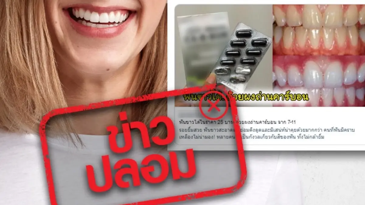 ข่าวปลอม ! ผงถ่านคาร์บอนไม่ช่วยทำให้ฟันขาว ซ้ำยังอันตรายต่อฟัน ข่าวปลอม ! ผงถ่านคาร์บอนไม่ช่วยทำให้ฟันขาว ซ้ำยังอันตรายต่อฟัน