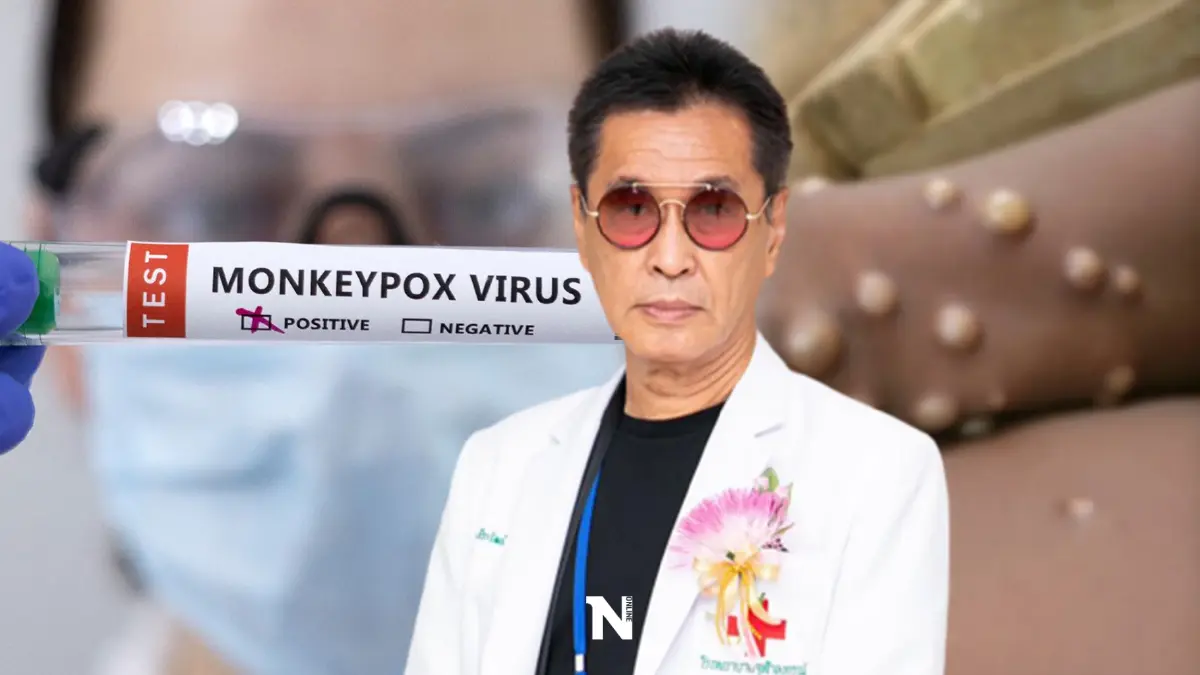 หมอธีระวัฒน์ ห่วงฝีดาษลิง "แม้ไม่ตาย แต่เสียโฉม" ย้ำวิธีป้องกันตัว หมอธีระวัฒน์ ห่วงฝีดาษลิง "แม้ไม่ตาย แต่เสียโฉม" ย้ำวิธีป้องกันตัว