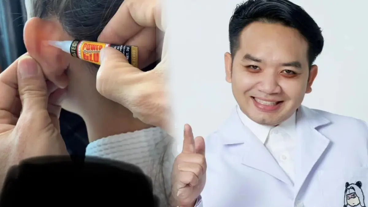 เตือนภัย “หมอแล็บ” อย่าหาทำเทรนด์ “กาวตราช้างทาหู” แก้หูกาง เตือนภัย “หมอแล็บ” อย่าหาทำเทรนด์ “กาวตราช้างทาหู” แก้หูกาง