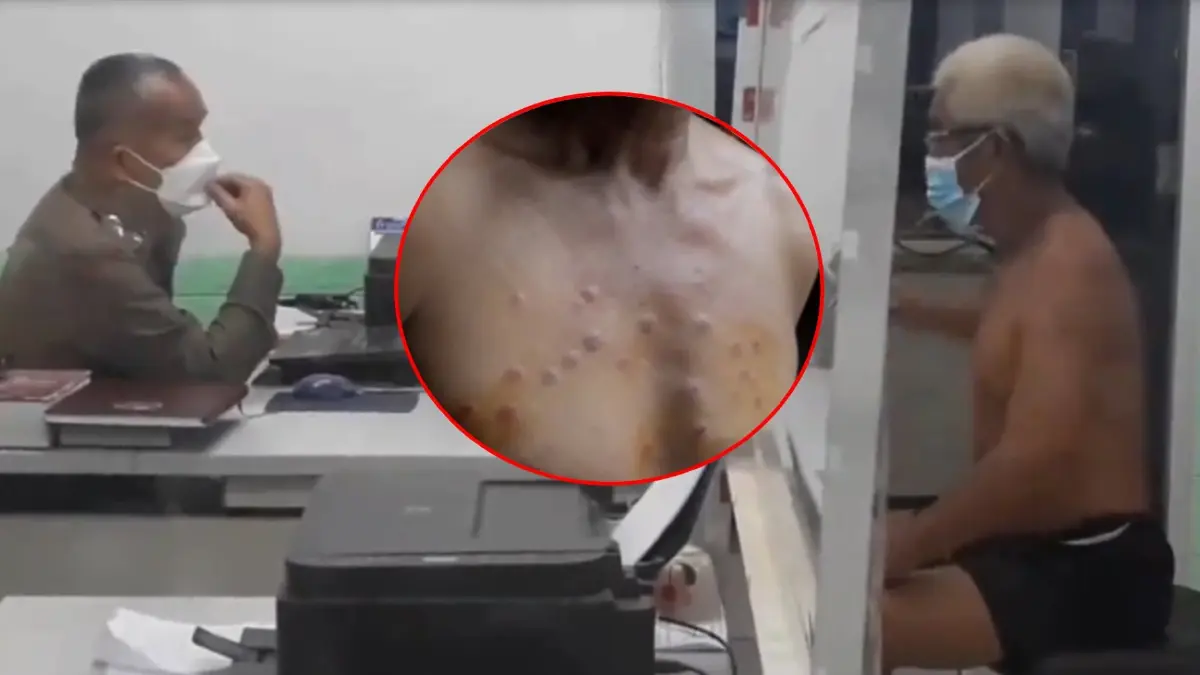 อึ้ง! ชายวัย 57 ปี ถูกคู่กรณีลั่นไกปืนใส่หน้าอก 30 นัด แต่ยิงไม่เข้า