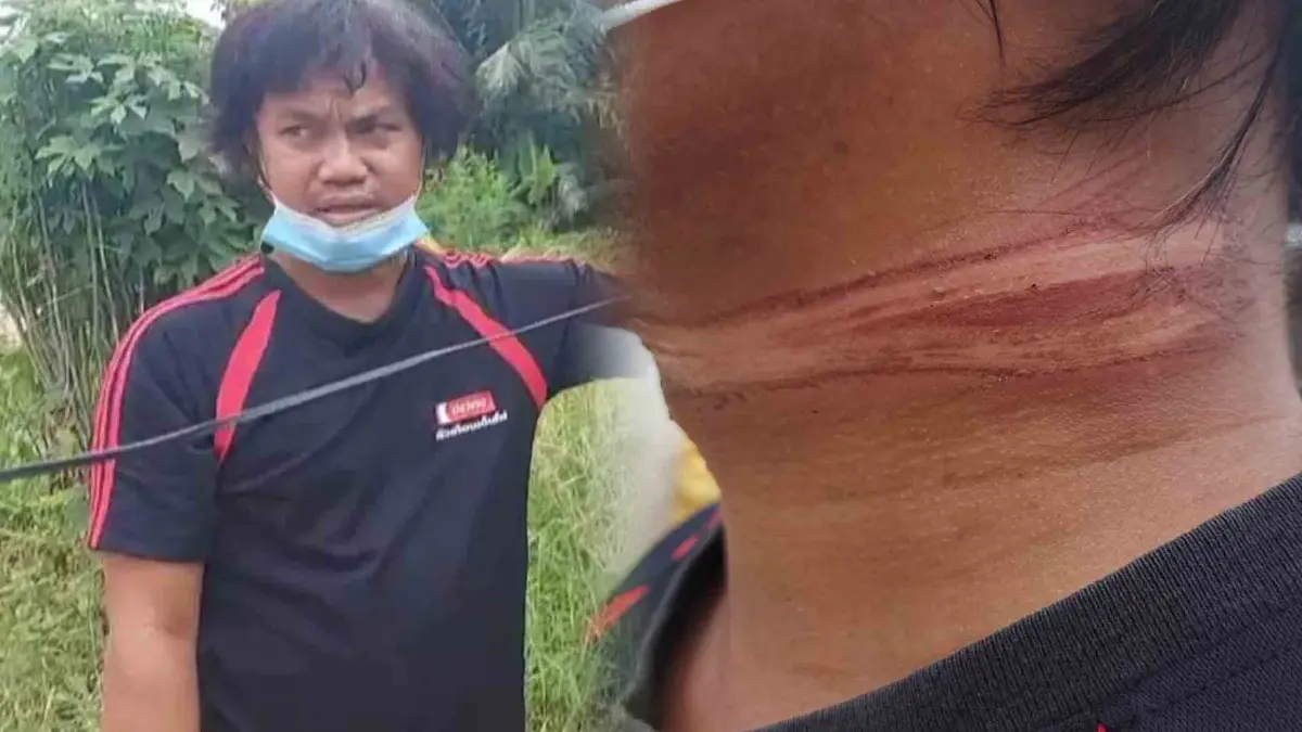 หนุ่มหวิดคอขาด เจอมือดีใช้สายสื่อสารขึงกลางถนนในหมู่บ้าน