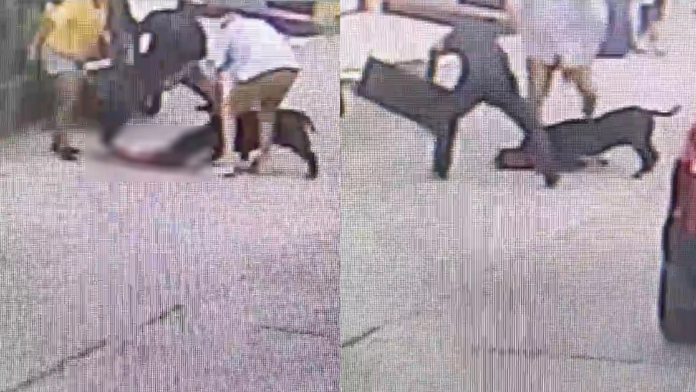 อีกแล้ว! สุนัขขย้ำหนูน้อยชาวต่างชาติ เย็บ 200 เข็ม ยังอยู่ไอซียู