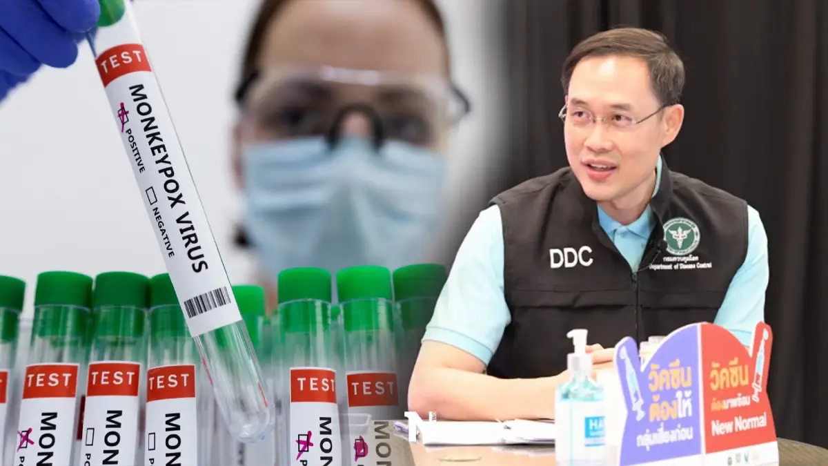 หมอหวั่นสัปดาห์หน้าเจอ "ฝีดาษลิง" เหตุรวมต่างชาติในงาน"ไพรด์ กรุงเทพฯ"