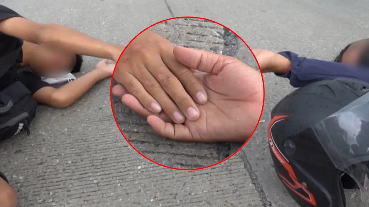 นาทีสะเทือนใจ! แม่เอื้อม "จับมือ" ลูกชายประสบอุบัติเหตุ จยย.ชนเจ็บทั้งคู่ นาทีสะเทือนใจ! แม่เอื้อม "จับมือ" ลูกชายประสบอุบัติเหตุ จยย.ชนเจ็บทั้งคู่