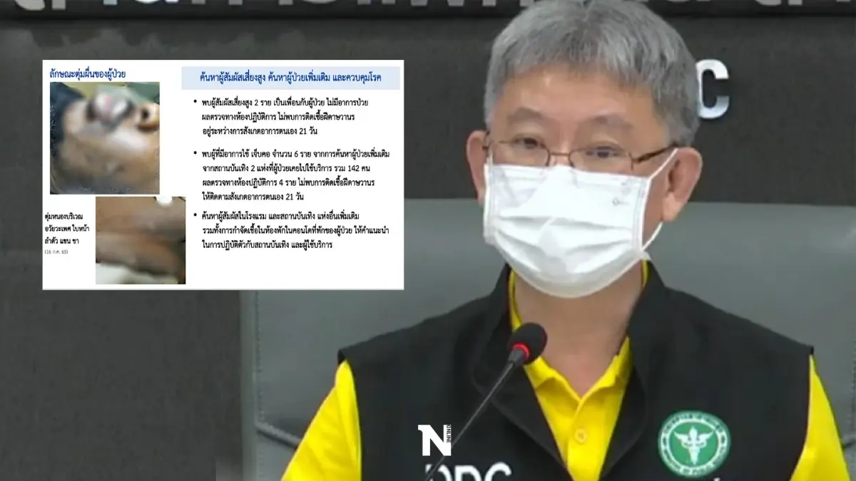 กรมควบคุมโรค แจงยิบ"ฝีดาษลิง"รายแรก เร่งติดตามกลุ่มเสี่ยง ไม่พบป่วยเพิ่ม