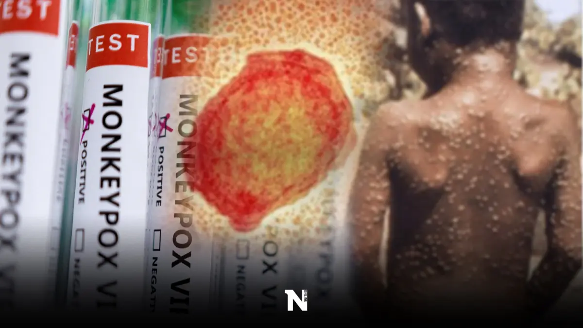 "ฝีดาษลิง"น่าห่วง แพทย์พบพันธุกรรมไวรัสในเลือด-อสุจิ หวั่นระบาดเหมือน HIV