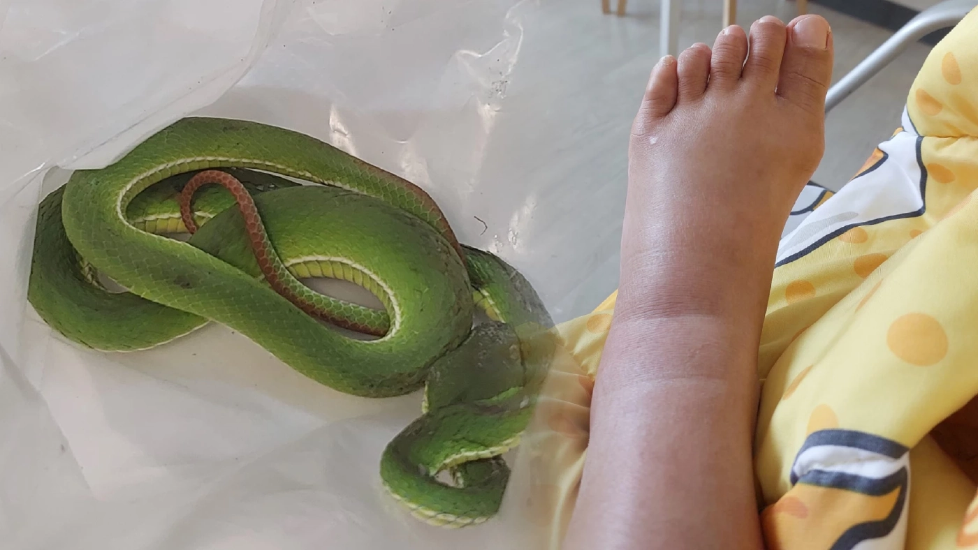 สาวโวย ถูกงูกัดในห้างดังย่านบางแค ห้างไม่รับผิดชอบบอกไม่ใช่เจ้าของงู สาวโวย ถูกงูกัดในห้างดังย่านบางแค ห้างไม่รับผิดชอบบอกไม่ใช่เจ้าของงู