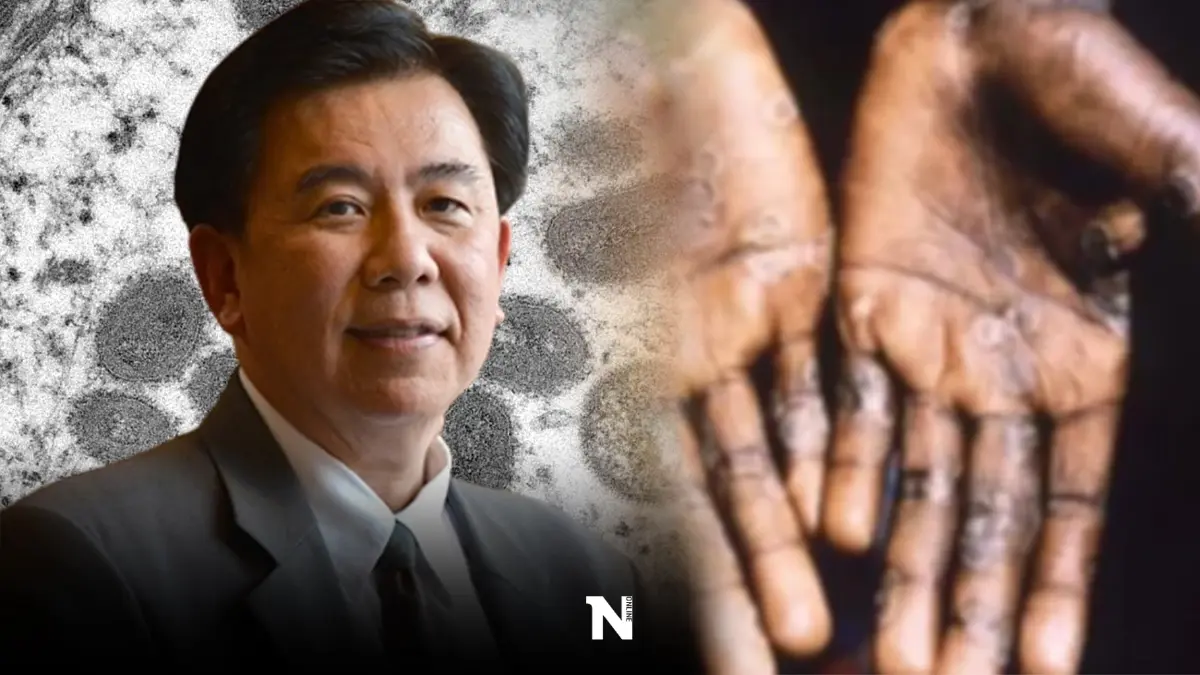 แพทย์เตือน "ฝีดาษลิง"วางใจไม่ได้ แพร่ 83 ประเทศ ไทยรายที่ 7 ติดจากเพศสัมพันธ์