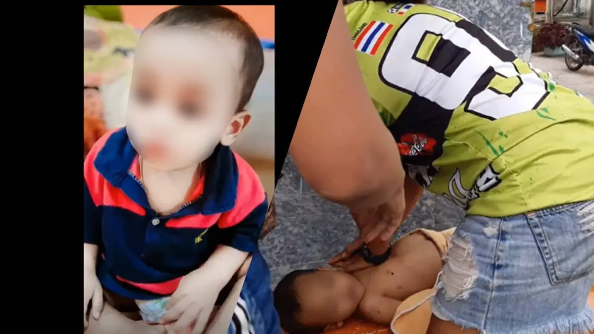 สุดยื้อ!! เด็กวัย 1 ขวบ ถูกพี่เลี้ยงโหดทำร้าย แพทย์เผยให้ญาติทำใจ สุดยื้อ!! เด็กวัย 1 ขวบ ถูกพี่เลี้ยงโหดทำร้าย แพทย์เผยให้ญาติทำใจ